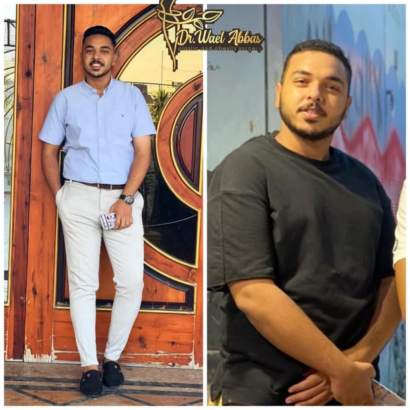 Before-After-1