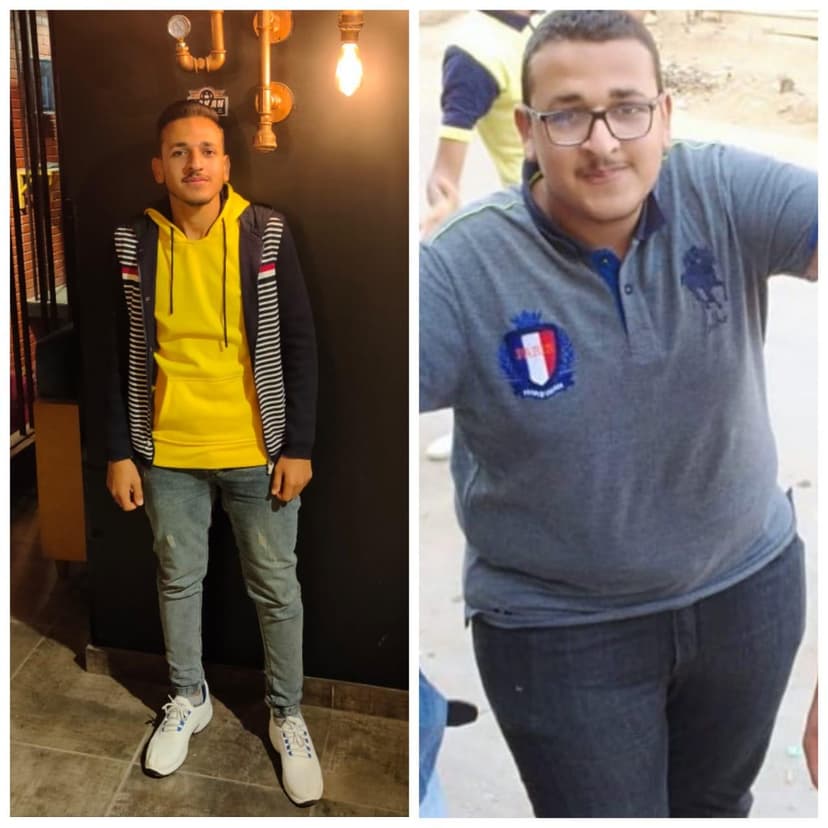Before-After-1