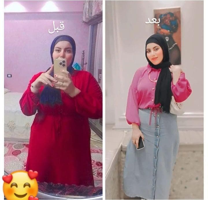 Before-After-1