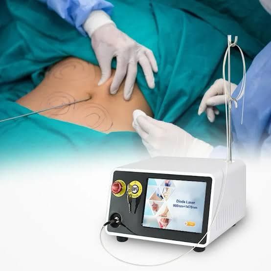 Diode Laser System
